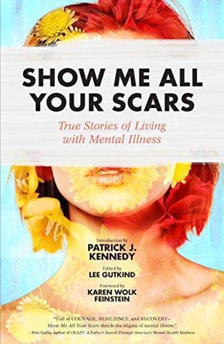 show Me All Your Scars