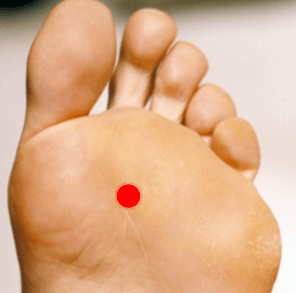 Midline In The Sole Of Foot